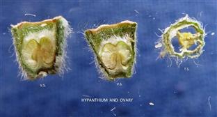  Ovary V.S. and T.S.